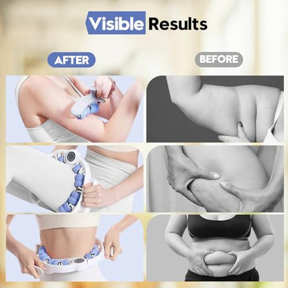 Anti-Cellulite Massage Roller with Handles for Legs & Thighs