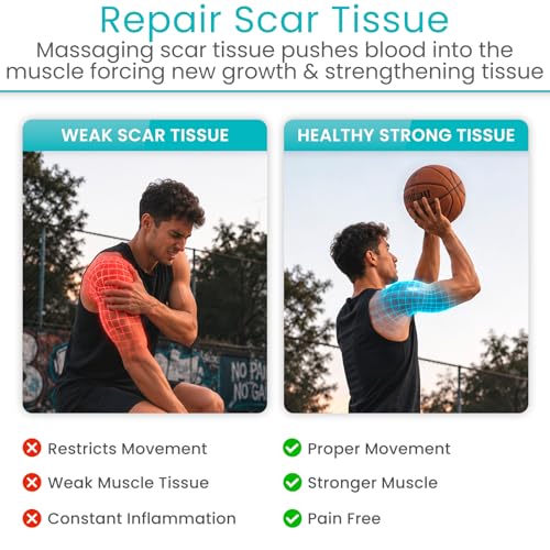 Vive Massage Cane with Roller - Interchangeable Heads - Trigger Point Tool - style: Massage Cane with Roller